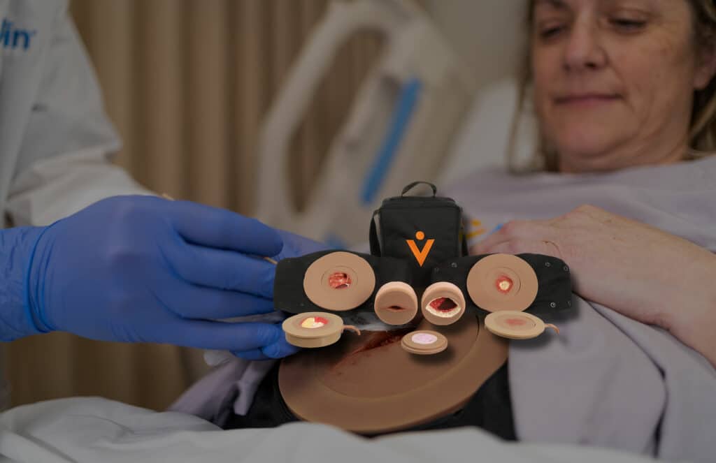 The Avwound can replicate all four stages of wound development.